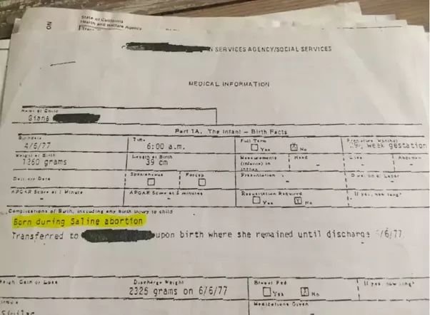 Medical record reproduced in the source article, with “Born during Saline abortion” highlighted.